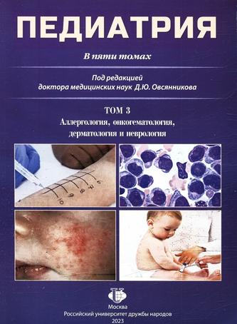 Превью