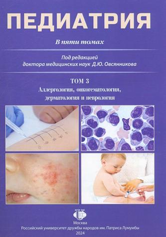 Превью